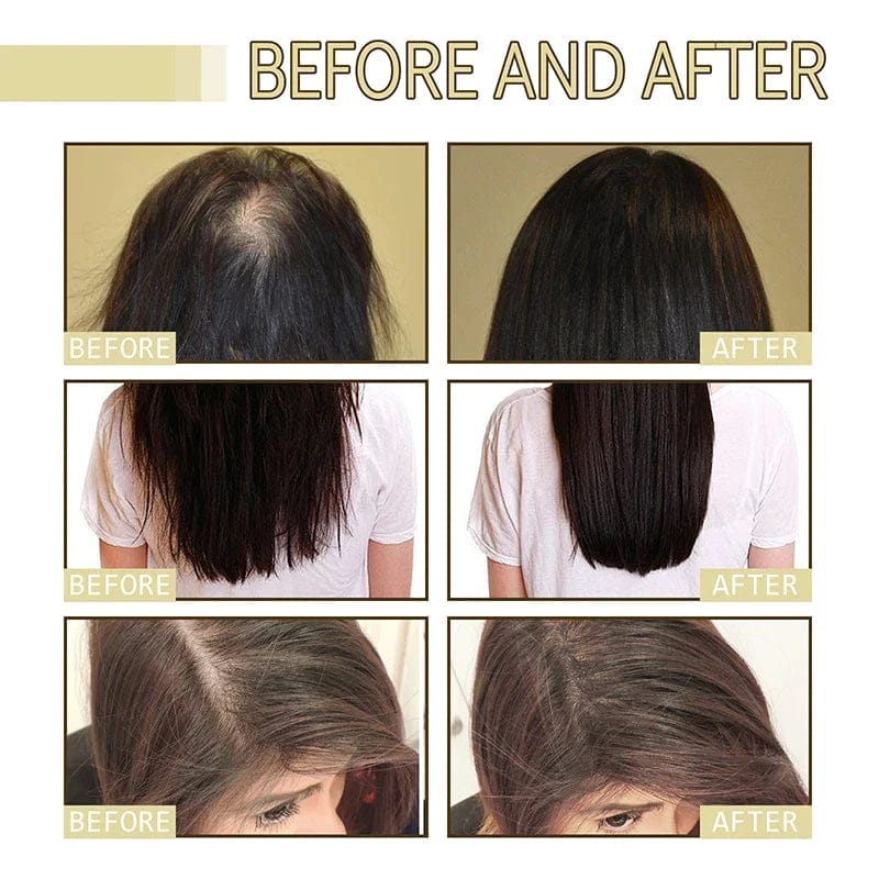 Neviux – Natural Hair Growth Oil – Hot Sale 50% OFF – Nemsoon